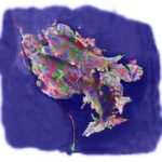 Hangnail by Langley Anderson, The CreARTe Foundation